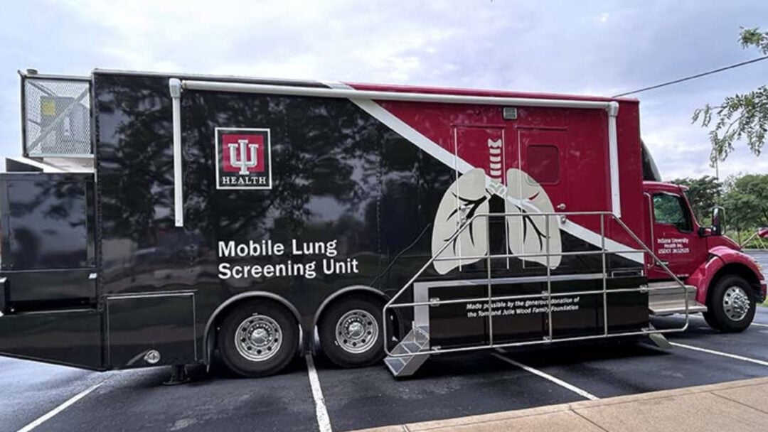 Mobile lung screening unit for early detection of lung cancer at NorthShore Health Centers.