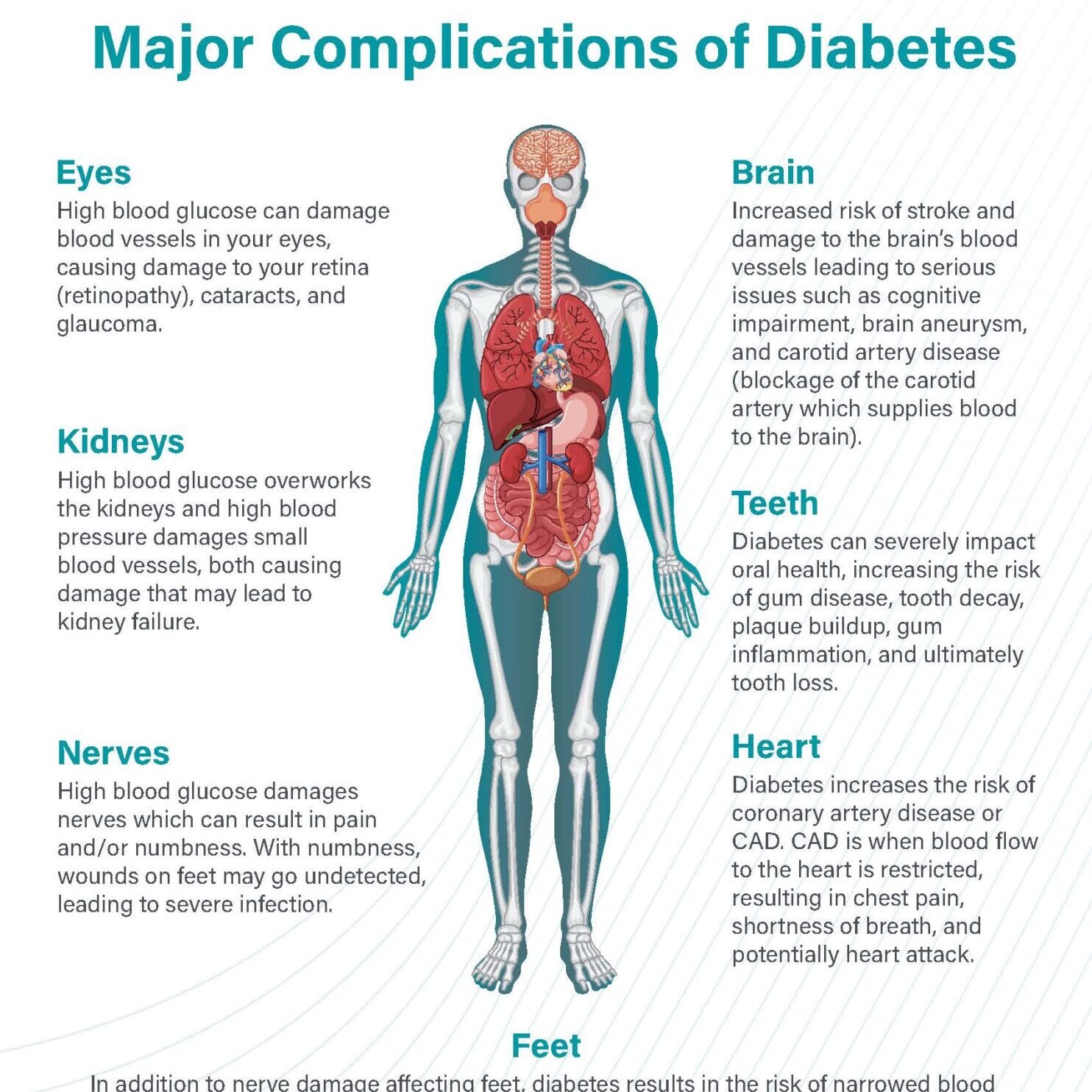 DIABETES