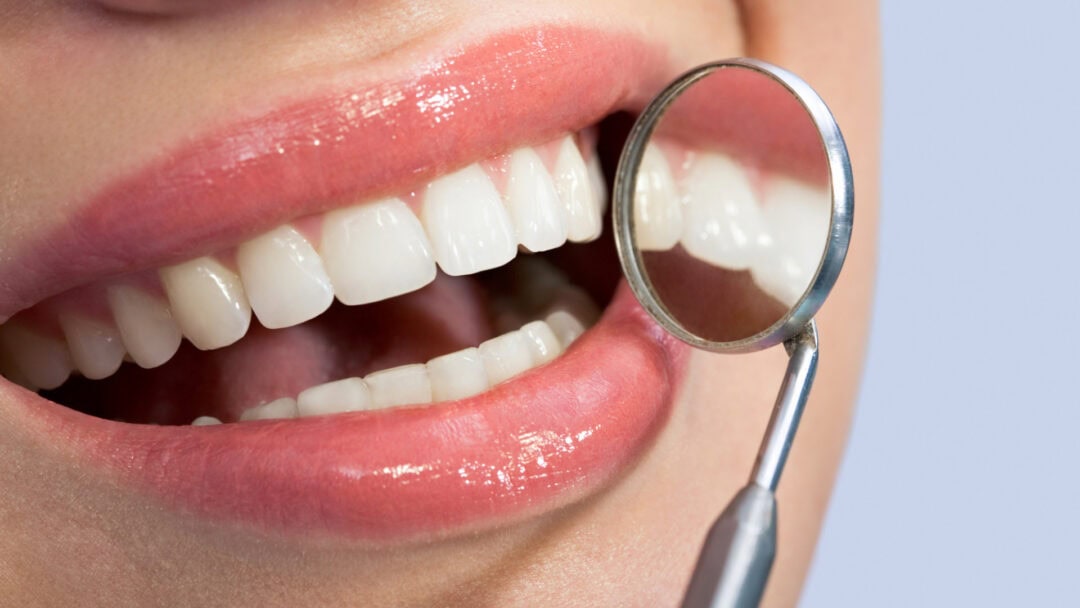 Dental health service for cavity prevention and tooth decay.